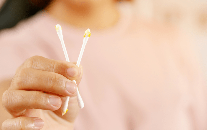Earwax impaction